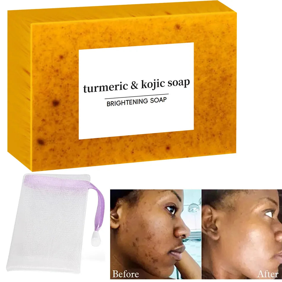 Turmeric & Kojic Soap